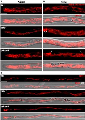 Distinct Contributions of the Peroxisome-Mitochondria Fission Machinery During Sexual Development of the Fungus <mark class="highlighted">Podospora</mark> anserina